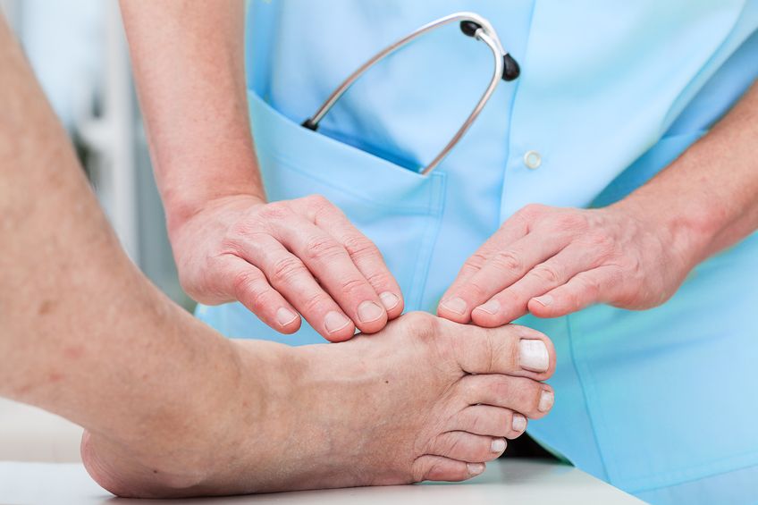 Hallux valgus - paluch koślawy